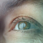 پرستاری از سالمند