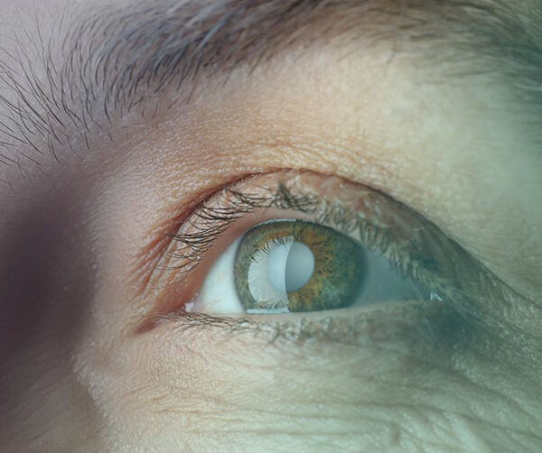 پرستاری از سالمند