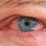 نگهدار سالمند در منزل