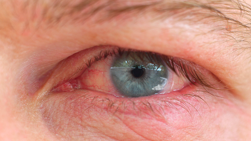 نگهدار سالمند در منزل