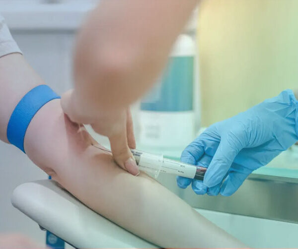 معرفی علایم آزمایش خون