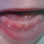 علائم دندان درآوردن نوزاد